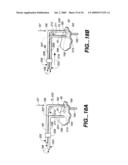 Surgical System and Procedure for Treatment of Medically Refractory Atrial Fibrillation diagram and image