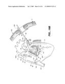 Surgical System and Procedure for Treatment of Medically Refractory Atrial Fibrillation diagram and image