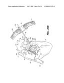 Surgical System and Procedure for Treatment of Medically Refractory Atrial Fibrillation diagram and image