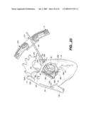 Surgical System and Procedure for Treatment of Medically Refractory Atrial Fibrillation diagram and image