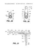 Surgical System and Procedure for Treatment of Medically Refractory Atrial Fibrillation diagram and image