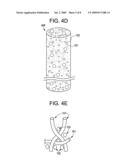 VASCULAR CLOSURE DEVICE diagram and image