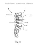 BONE FUSION DEVICE AND METHODS diagram and image