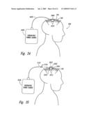METHODS AND APPARATUS FOR EFFECTUATING A LASTING CHANGE IN A NEURAL-FUNCTION OF A PATIENT diagram and image