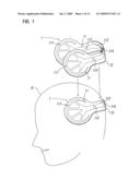 Head Orthosis diagram and image