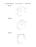 Head Orthosis diagram and image