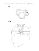 Head Orthosis diagram and image