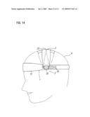 Head Orthosis diagram and image