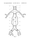 IMPLANTABLE GRAFT DEVICE HAVING TREATED YARN AND METHOD FOR MAKING SAME diagram and image