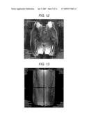 MAGNETIC RESONANCE IMAGING APPARATUS AND MAGNETIC RESONANCE IMAGING METHOD diagram and image