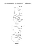 METAL RETAINING FEATURES FOR HANDHELD ELECTRONIC DEVICE CASING diagram and image