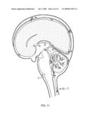 HUMANIZED ANTI-AMYLOID BETA ANTIBODIES diagram and image