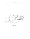 HUMANIZED ANTI-AMYLOID BETA ANTIBODIES diagram and image