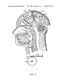 HUMANIZED ANTI-AMYLOID BETA ANTIBODIES diagram and image