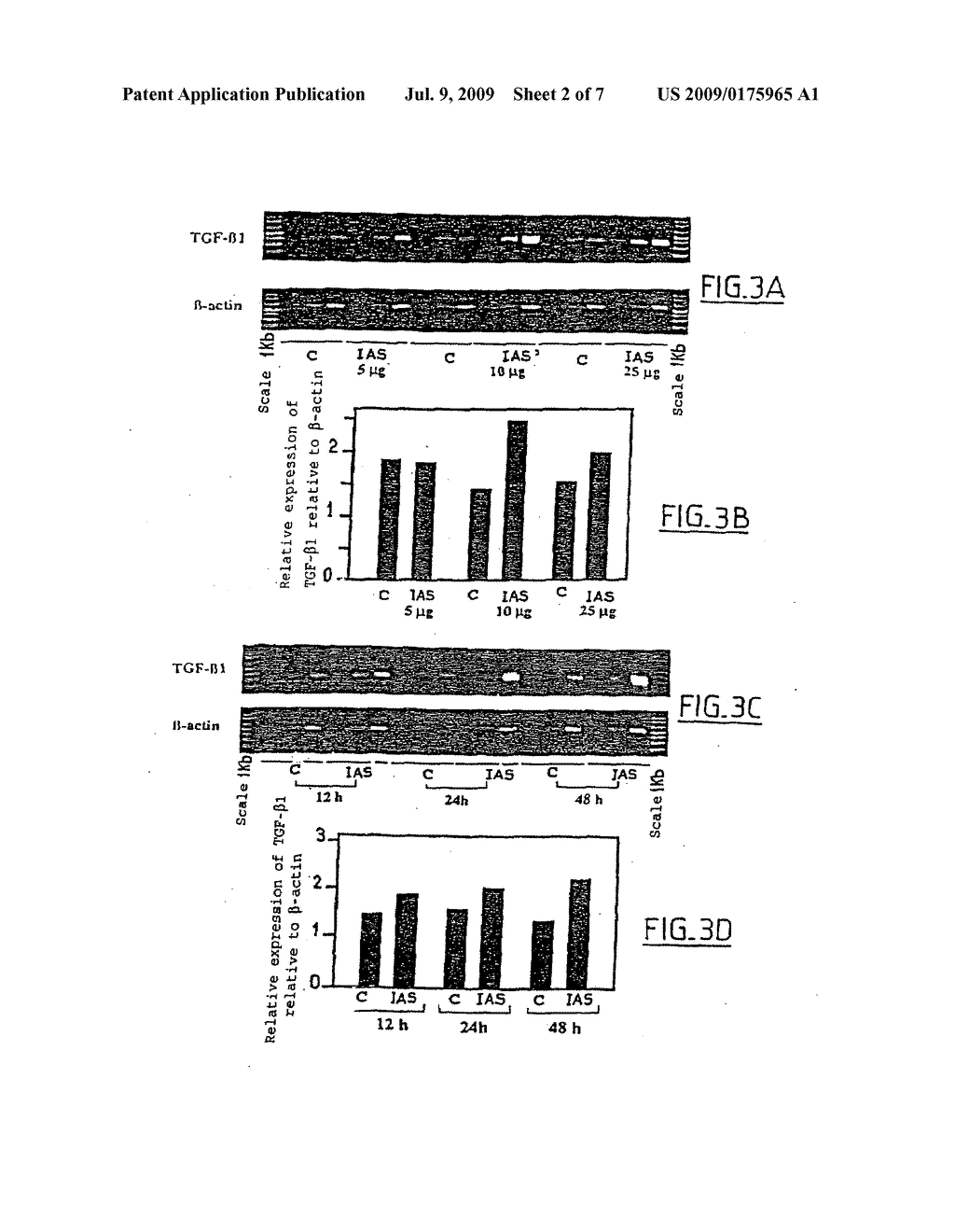 USE OF UNSAPONIFIABLE COMPONENTS OF VEGETABLE OILS FOR PREPARING A COSMETIC AND RELATED TREATMENTS - diagram, schematic, and image 03