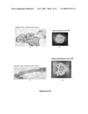 Betulinol derivatives as anti-cancer agents diagram and image