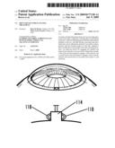 Shunt Device for Glaucoma Treatment diagram and image