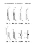 Shunt Device for Glaucoma Treatment diagram and image