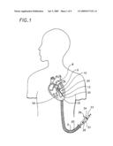 Catheter Drug Delivery System and Method for Use diagram and image