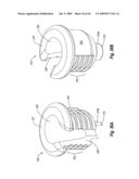 REDUCED FRICTION CATHETER INTRODUCER AND METHOD OF MANUFACTURING AND USING THE SAME diagram and image