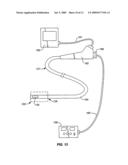 AUTO-ALIGNING ABLATING DEVICE AND METHOD OF USE diagram and image