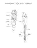 Devices, systems and methods for re-alignment of bone diagram and image