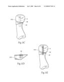 Devices, systems and methods for re-alignment of bone diagram and image