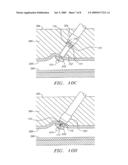 CLOSURE DEVICE AND METHODS FOR MAKING AND USING THEM diagram and image