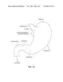 SATIATION POUCHES AND METHODS OF USE diagram and image