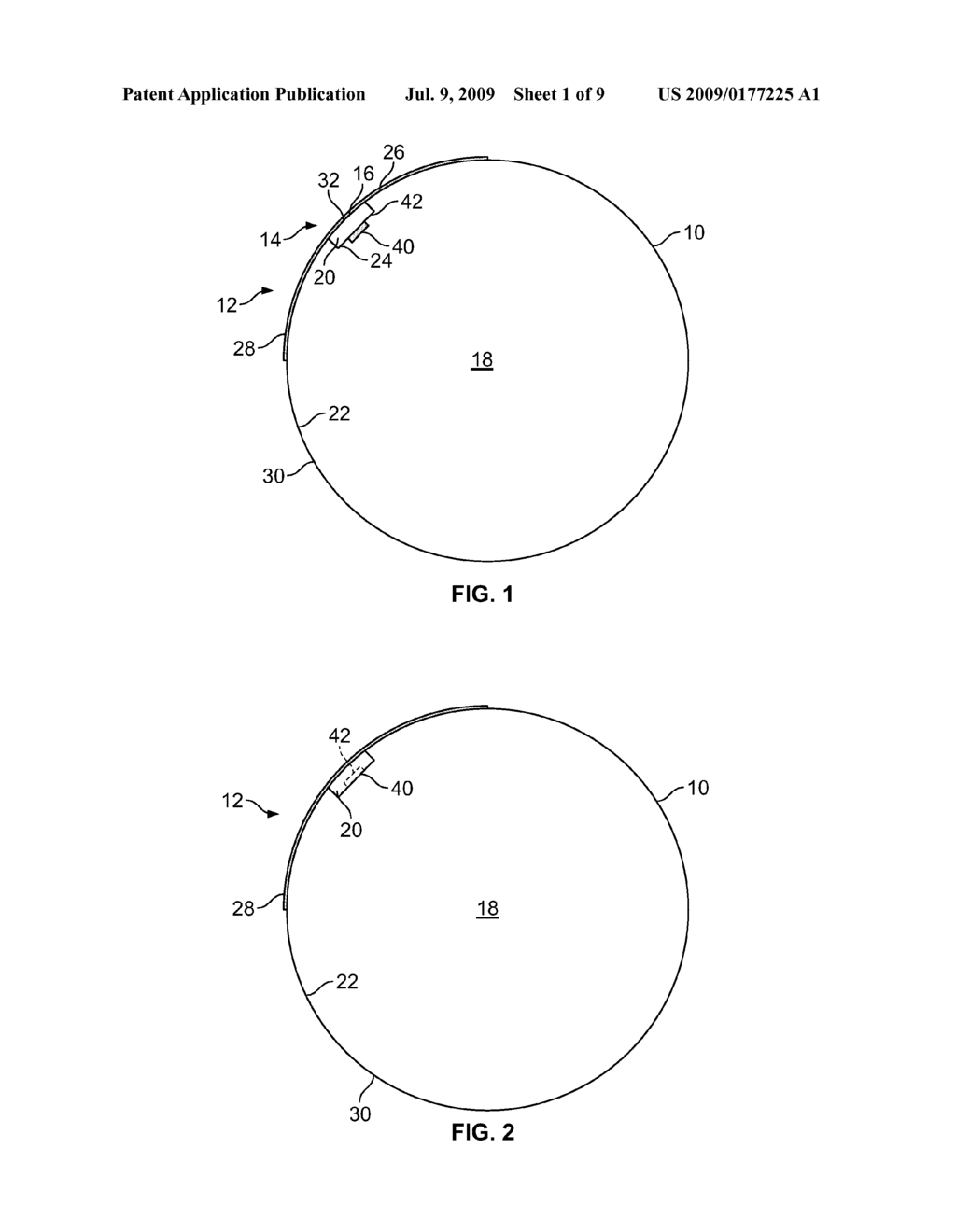 Vascular closure device having sensor - diagram, schematic, and image 02