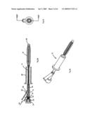 Apparatus and methods for bone, tissue and duct dilatation diagram and image