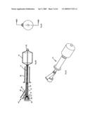 Apparatus and methods for bone, tissue and duct dilatation diagram and image