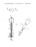 Apparatus and methods for bone, tissue and duct dilatation diagram and image