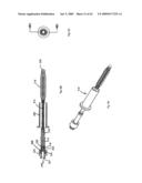 Apparatus and methods for bone, tissue and duct dilatation diagram and image