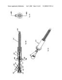 Apparatus and methods for bone, tissue and duct dilatation diagram and image