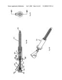 Apparatus and methods for bone, tissue and duct dilatation diagram and image