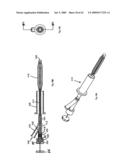 Apparatus and methods for bone, tissue and duct dilatation diagram and image