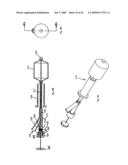 Apparatus and methods for bone, tissue and duct dilatation diagram and image