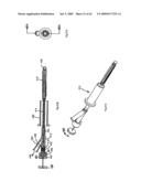 Apparatus and methods for bone, tissue and duct dilatation diagram and image