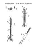 Apparatus and methods for bone, tissue and duct dilatation diagram and image