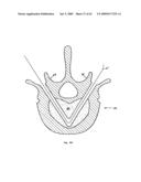 Apparatus and methods for bone, tissue and duct dilatation diagram and image