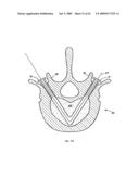 Apparatus and methods for bone, tissue and duct dilatation diagram and image