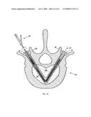 Apparatus and methods for bone, tissue and duct dilatation diagram and image