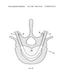 Apparatus and methods for bone, tissue and duct dilatation diagram and image