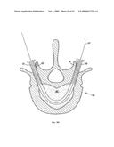 Apparatus and methods for bone, tissue and duct dilatation diagram and image