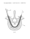 Apparatus and methods for bone, tissue and duct dilatation diagram and image