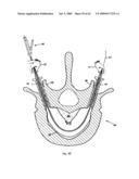 Apparatus and methods for bone, tissue and duct dilatation diagram and image