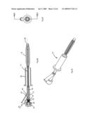 Apparatus and methods for bone, tissue and duct dilatation diagram and image