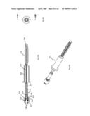 Apparatus and methods for bone, tissue and duct dilatation diagram and image