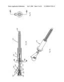 Apparatus and methods for bone, tissue and duct dilatation diagram and image